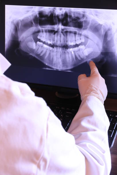 Best Emergency Wisdom Tooth Extraction in Maitland, FL